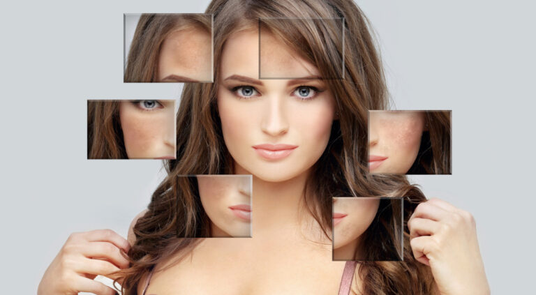 ما هي اسباب تصبغات البشرة؟ وما هي انواعها وطرق علاجها؟